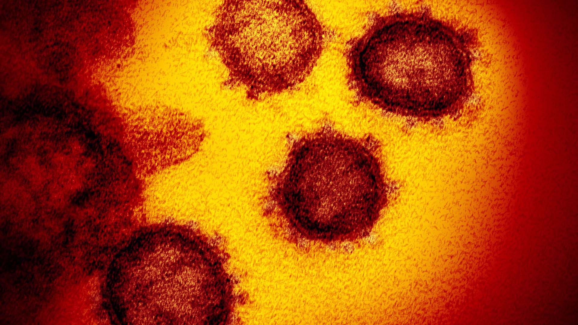 Un anticorps pourrait agir comme un «passe-partout» capable de vaincre toutes les mutations du virus 