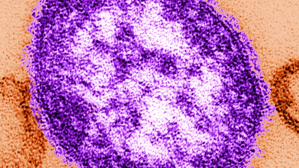 Measles Exposure Fears at Montreal NATO Summit