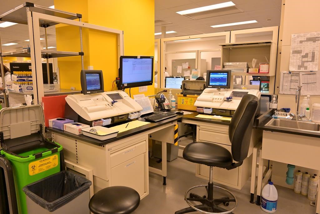 Le Centre hospitalier de l'Universite de Montral (CHUM) est un centre supraregional qui recoit des echantillons &nbsp;a analyser en laboratoire de partout au Quebec. Il recoit chaque jour 10 000 echantillons.